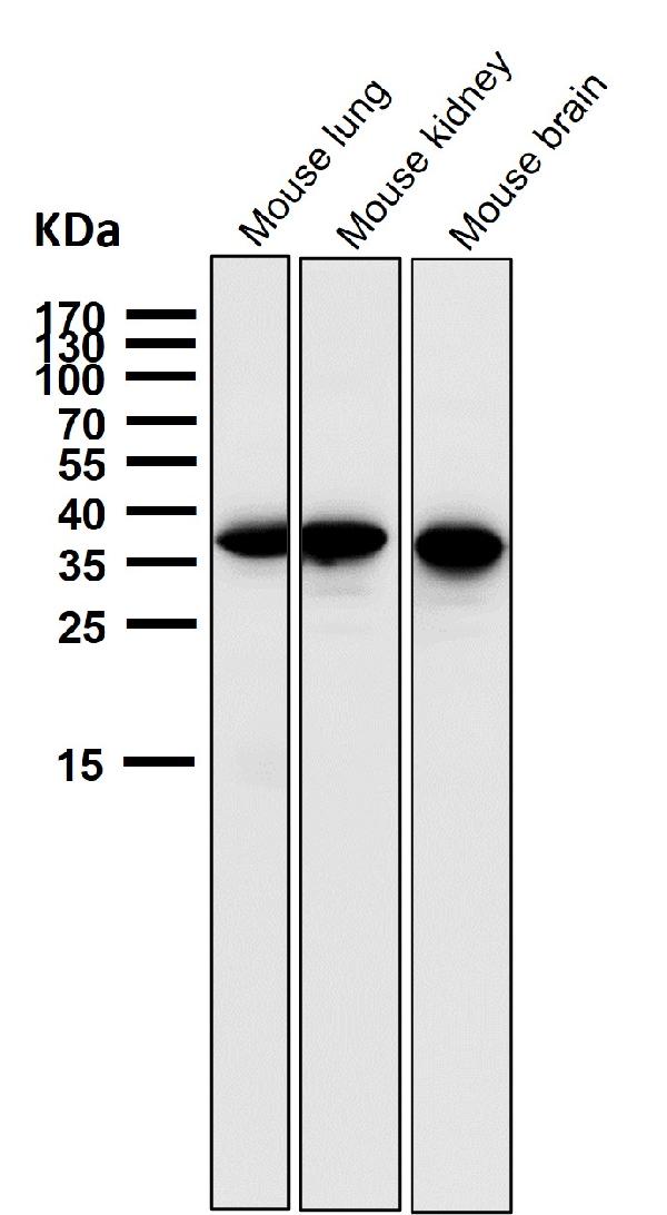 1 - Anti-Gamma glutamyl hydrolase Rabbit Monoclonal Antibody ABO16646
