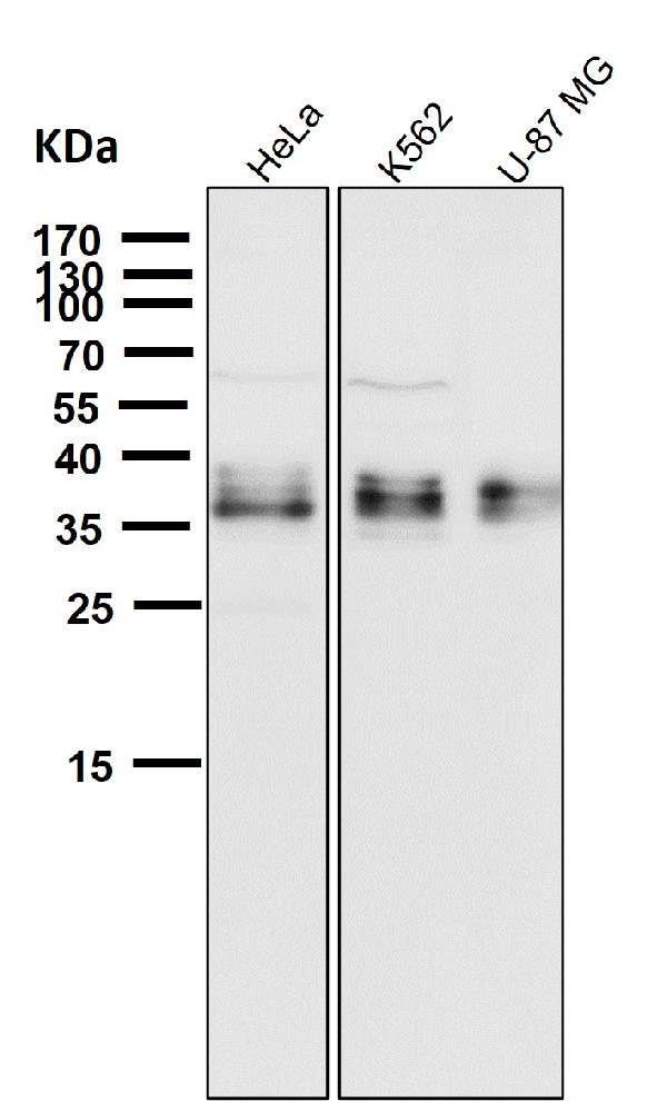1 - Anti-Gamma glutamyl hydrolase Rabbit Monoclonal Antibody ABO16646