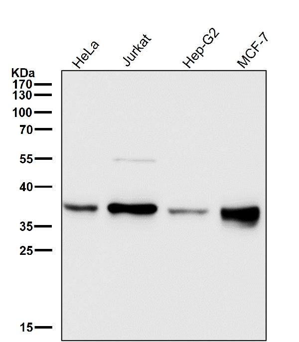 1 - Anti-Gamma glutamyl hydrolase Rabbit Monoclonal Antibody ABO16646