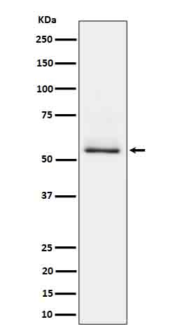 1 - Anti-Phospho-Tau (S404) Rabbit Monoclonal Antibody ABO16649
