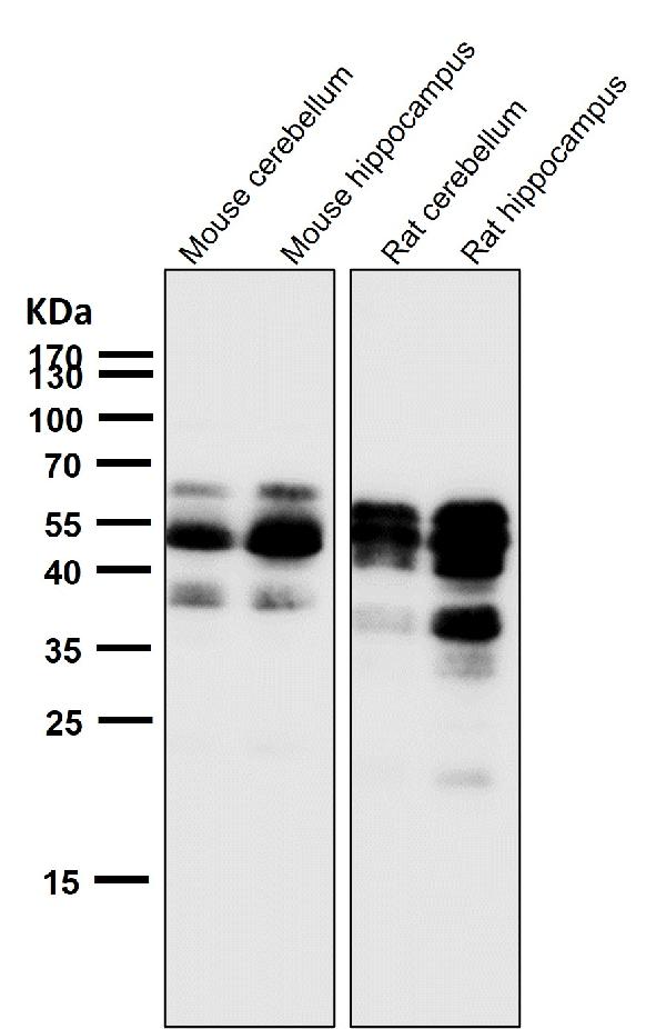 1 - Anti-Phospho-Tau (S404) Rabbit Monoclonal Antibody ABO16649