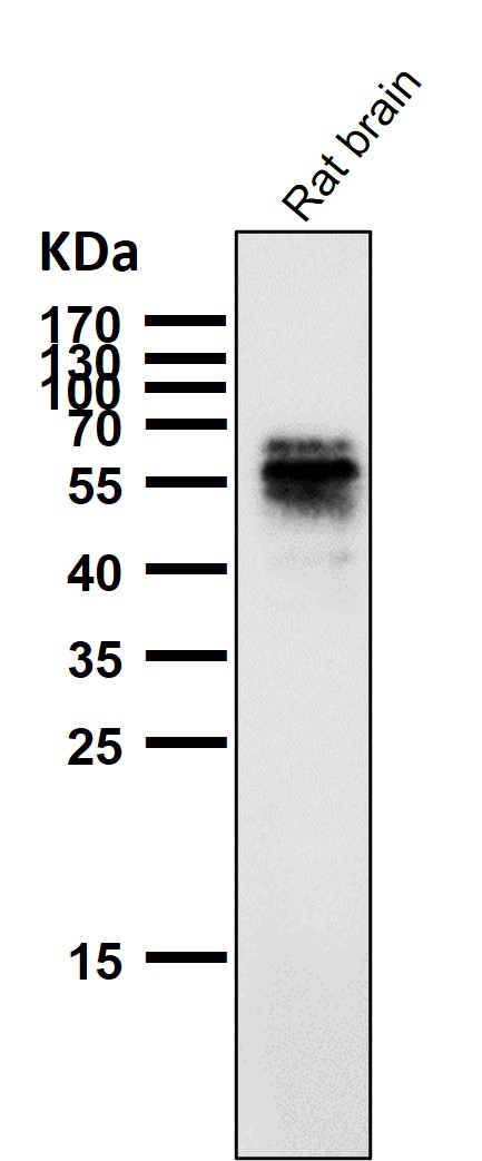 1 - Anti-Phospho-Tau (S214) Rabbit Monoclonal Antibody ABO16650
