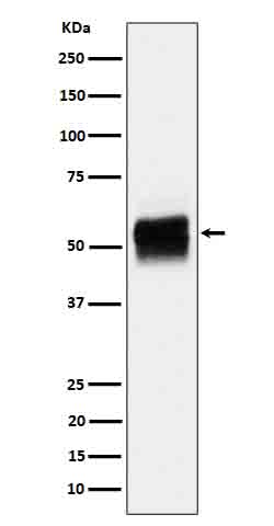 1 - Anti-Phospho-Tau (S202) Rabbit Monoclonal Antibody ABO16651