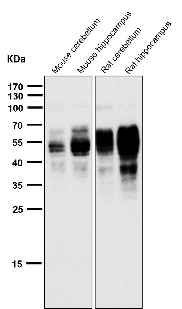 1 - Anti-Phospho-Tau (S202) Rabbit Monoclonal Antibody ABO16651