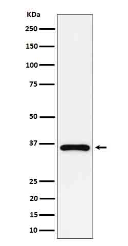 1 - Anti-GAS2 Rabbit Monoclonal Antibody ABO16652