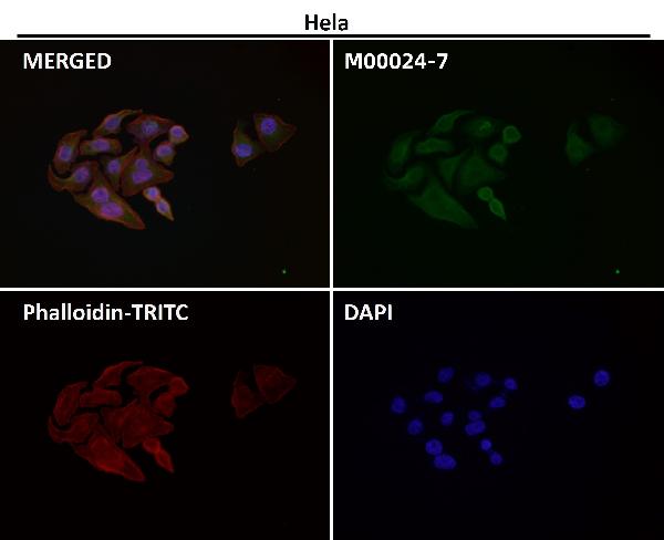 1 - Anti-AKT1 + AKT2 + AKT3 Rabbit Monoclonal Antibody ABO16653