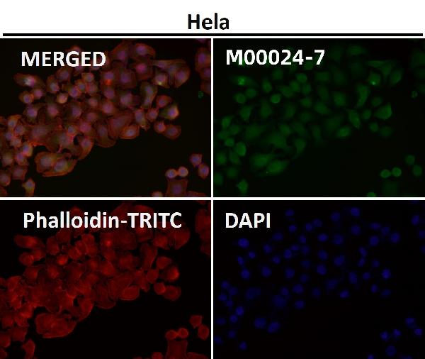 1 - Anti-AKT1 + AKT2 + AKT3 Rabbit Monoclonal Antibody ABO16653