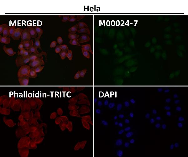 1 - Anti-AKT1 + AKT2 + AKT3 Rabbit Monoclonal Antibody ABO16653