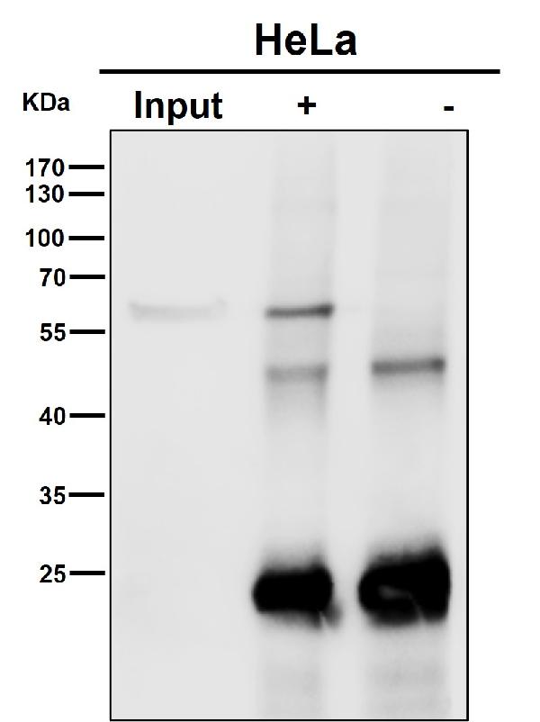 1 - Anti-AKT1 + AKT2 + AKT3 Rabbit Monoclonal Antibody ABO16653