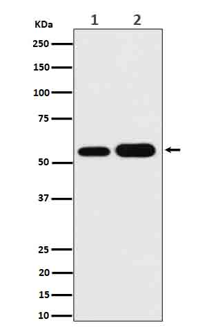 1 - Anti-AKT1 + AKT2 + AKT3 Rabbit Monoclonal Antibody ABO16653