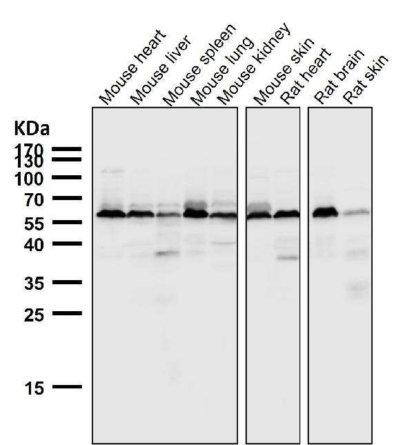 1 - Anti-AKT1 + AKT2 + AKT3 Rabbit Monoclonal Antibody ABO16653