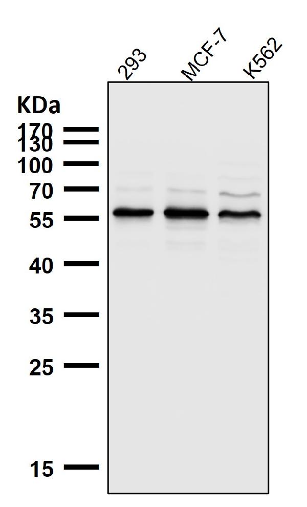 1 - Anti-AKT1 + AKT2 + AKT3 Rabbit Monoclonal Antibody ABO16653