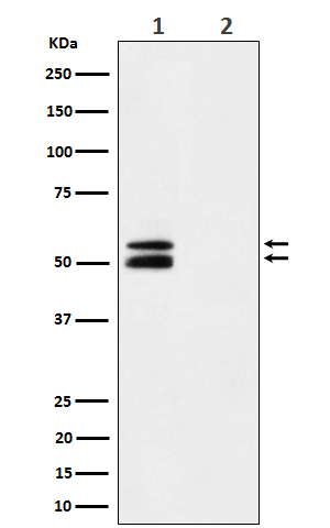 1 - Anti-Phospho-CaMKII alpha (T286) Rabbit Monoclonal Antibody ABO16655