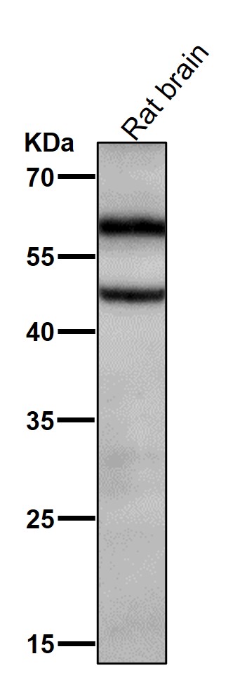1 - Anti-Phospho-CaMKII alpha (T286) Rabbit Monoclonal Antibody ABO16655
