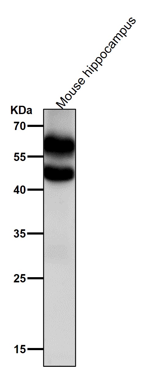 1 - Anti-Phospho-CaMKII alpha (T286) Rabbit Monoclonal Antibody ABO16655