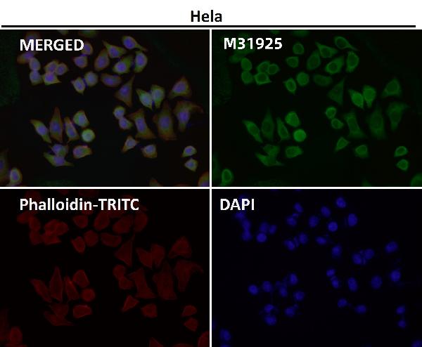 1 - Anti-HN1 Rabbit Monoclonal Antibody ABO16656