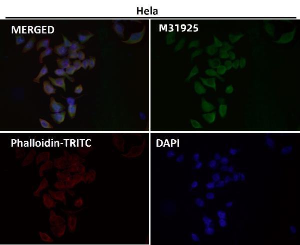 1 - Anti-HN1 Rabbit Monoclonal Antibody ABO16656