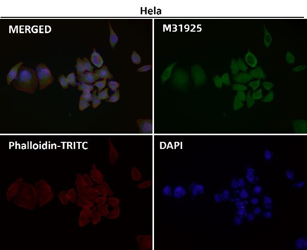 1 - Anti-HN1 Rabbit Monoclonal Antibody ABO16656