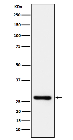 1 - Anti-DcR1 / CD263 Rabbit Monoclonal Antibody ABO16657