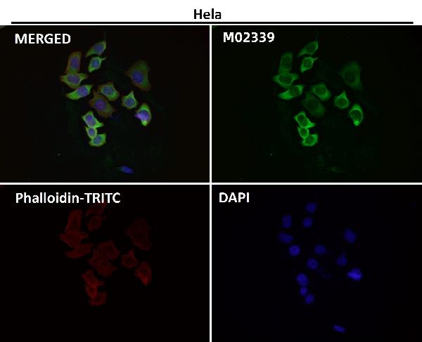 1 - Anti-eIF3A Rabbit Monoclonal Antibody ABO16658