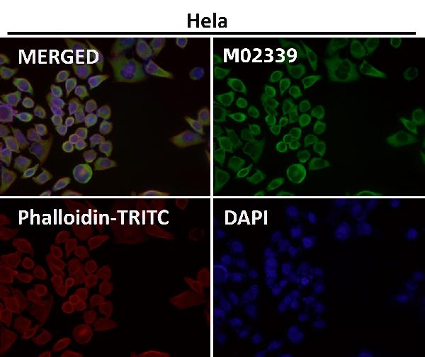 1 - Anti-eIF3A Rabbit Monoclonal Antibody ABO16658