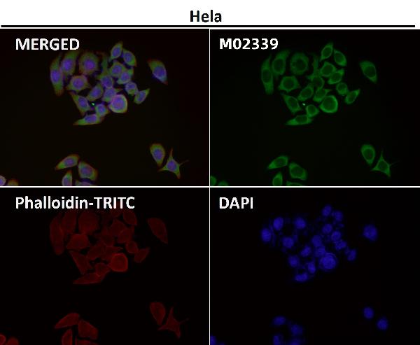 1 - Anti-eIF3A Rabbit Monoclonal Antibody ABO16658