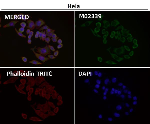 1 - Anti-eIF3A Rabbit Monoclonal Antibody ABO16658