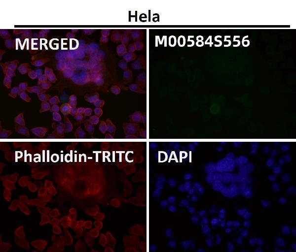 1 - Anti-Phospho-ULK1 (S556) Rabbit Monoclonal Antibody ABO16659