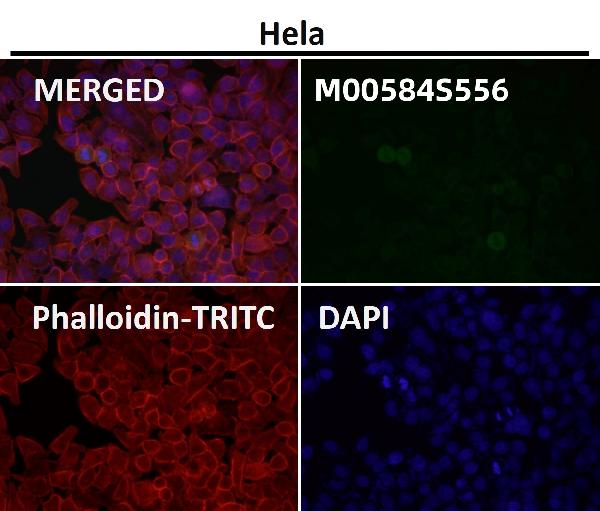 1 - Anti-Phospho-ULK1 (S556) Rabbit Monoclonal Antibody ABO16659