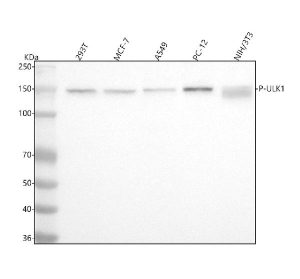1 - Anti-Phospho-ULK1 (S556) Rabbit Monoclonal Antibody ABO16659