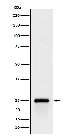 1 - Anti-GSTA4 Rabbit Monoclonal Antibody ABO16660