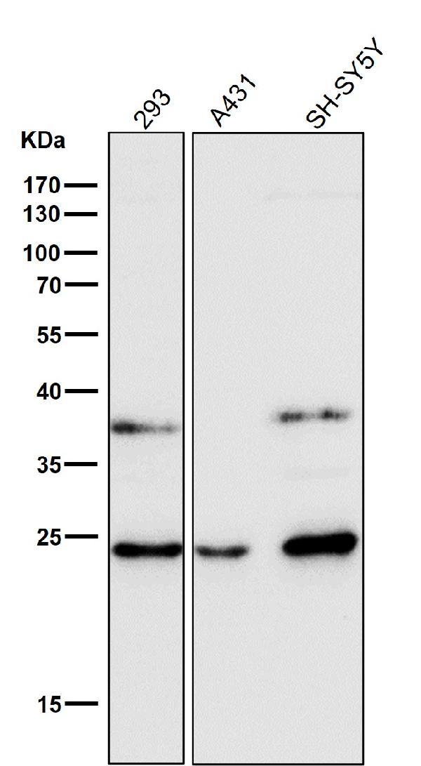 1 - Anti-GSTA4 Rabbit Monoclonal Antibody ABO16660