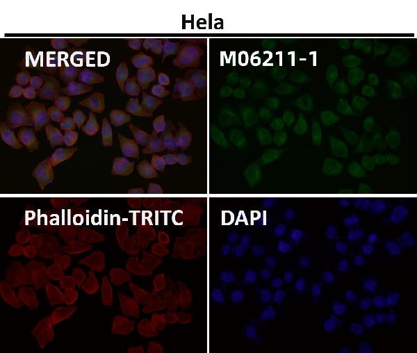 1 - Anti-SEC14L2 / TAP Rabbit Monoclonal Antibody ABO16661