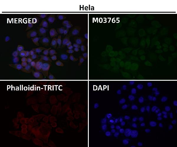 1 - Anti-NFE2 Rabbit Monoclonal Antibody ABO16662