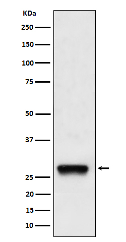 1 - Anti-PDGF B Rabbit Monoclonal Antibody ABO16663