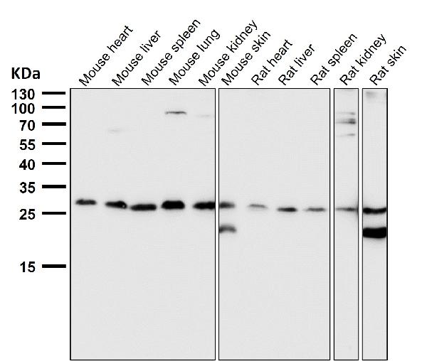 1 - Anti-PDGF B Rabbit Monoclonal Antibody ABO16663