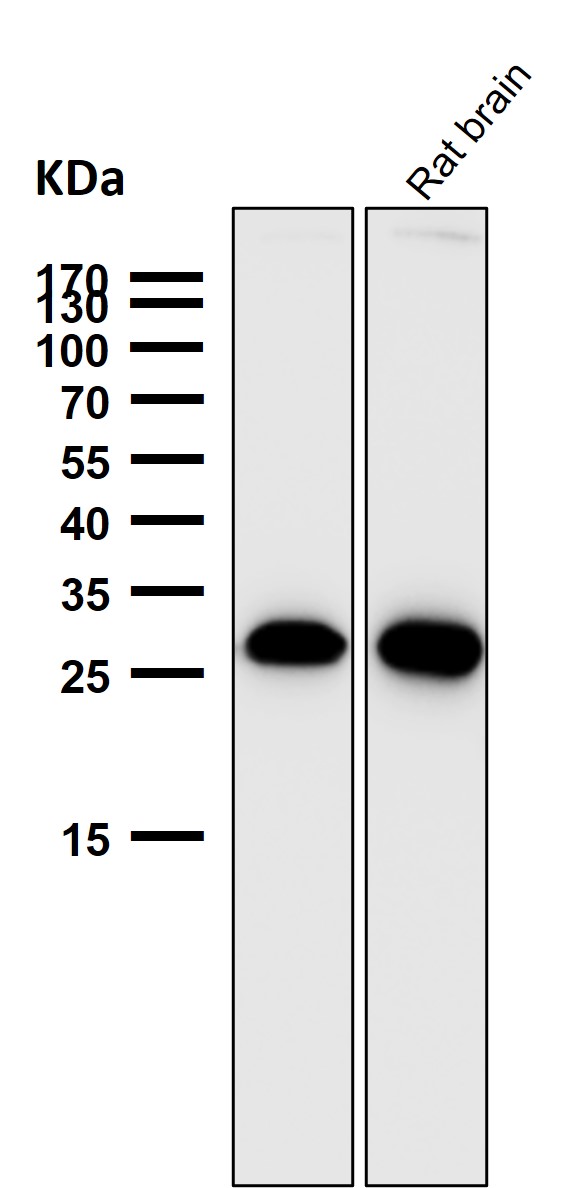 1 - Anti-PDGF B Rabbit Monoclonal Antibody ABO16663