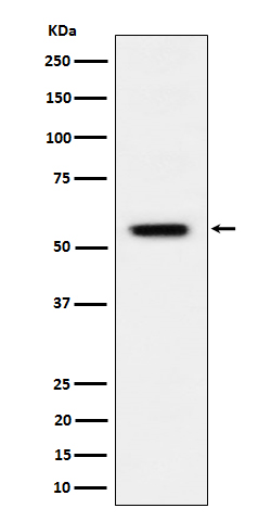 1 - Anti-Phospho-Vimentin (S39) Rabbit Monoclonal Antibody ABO16664