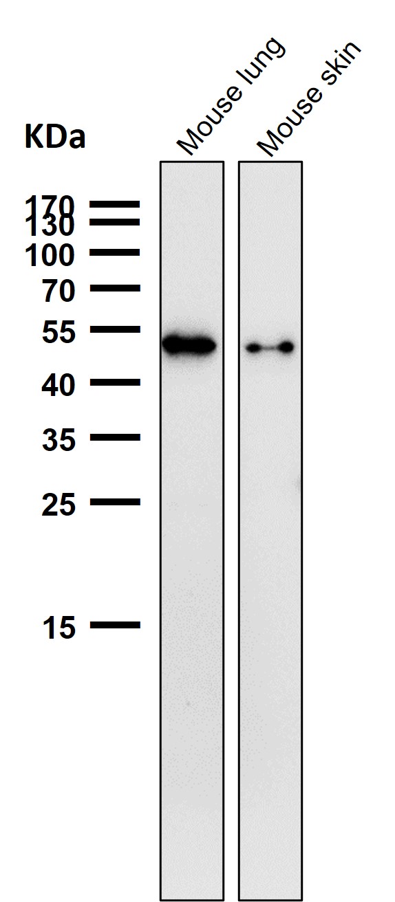 1 - Anti-Phospho-Vimentin (S39) Rabbit Monoclonal Antibody ABO16664