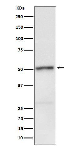 1 - Anti-Phospho-RIP3 (S232) Rabbit Monoclonal Antibody ABO16665