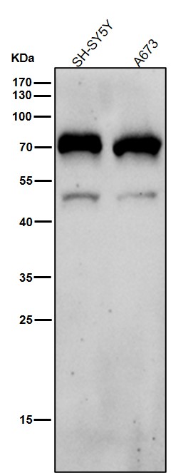 1 - Anti-NR2C2 / TR4 Rabbit Monoclonal Antibody ABO16666