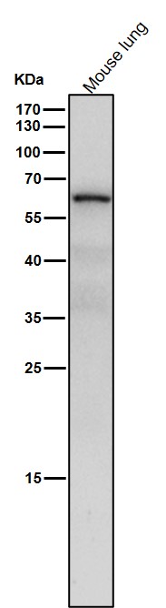 1 - Anti-NR2C2 / TR4 Rabbit Monoclonal Antibody ABO16666