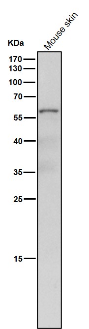 1 - Anti-NR2C2 / TR4 Rabbit Monoclonal Antibody ABO16666