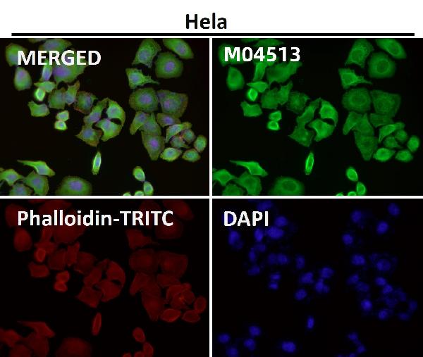 1 - Anti-Lunatic Fringe Rabbit Monoclonal Antibody ABO16668