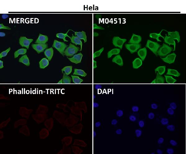 1 - Anti-Lunatic Fringe Rabbit Monoclonal Antibody ABO16668