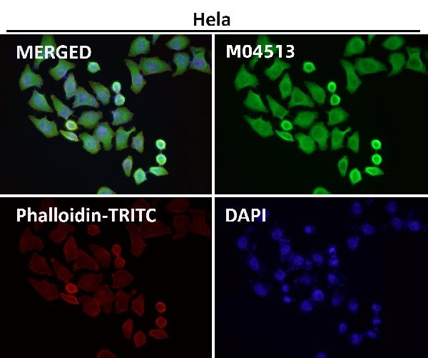 1 - Anti-Lunatic Fringe Rabbit Monoclonal Antibody ABO16668