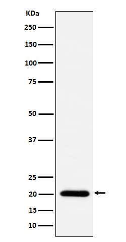 1 - Anti-TIMM22 Rabbit Monoclonal Antibody ABO16669