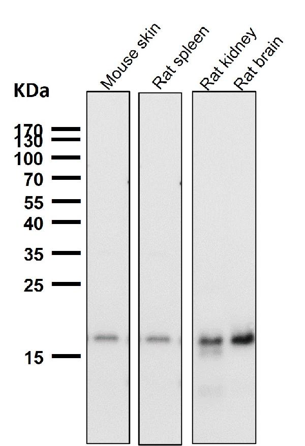 1 - Anti-TIMM22 Rabbit Monoclonal Antibody ABO16669