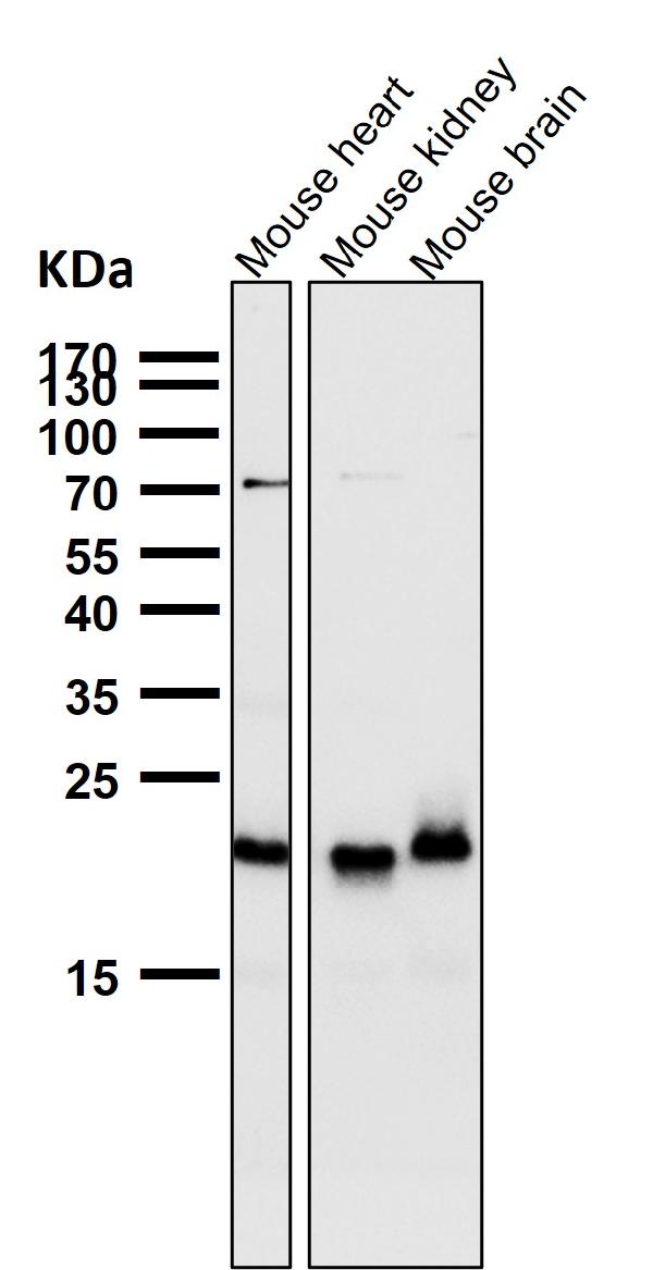 1 - Anti-TIMM22 Rabbit Monoclonal Antibody ABO16669