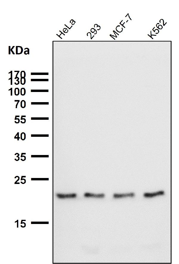 1 - Anti-TIMM22 Rabbit Monoclonal Antibody ABO16669